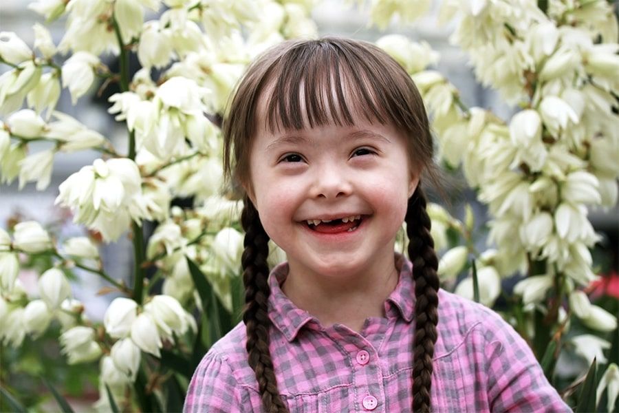 Hội chứng Down (Trisomy 21)