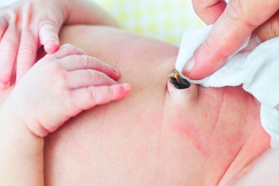 https://9thang10ngay.net/uploads/LGH_Health_Hub_Motherhood_1200x600_Umbilical_Cord_Care_f2c5e789e2.jpg