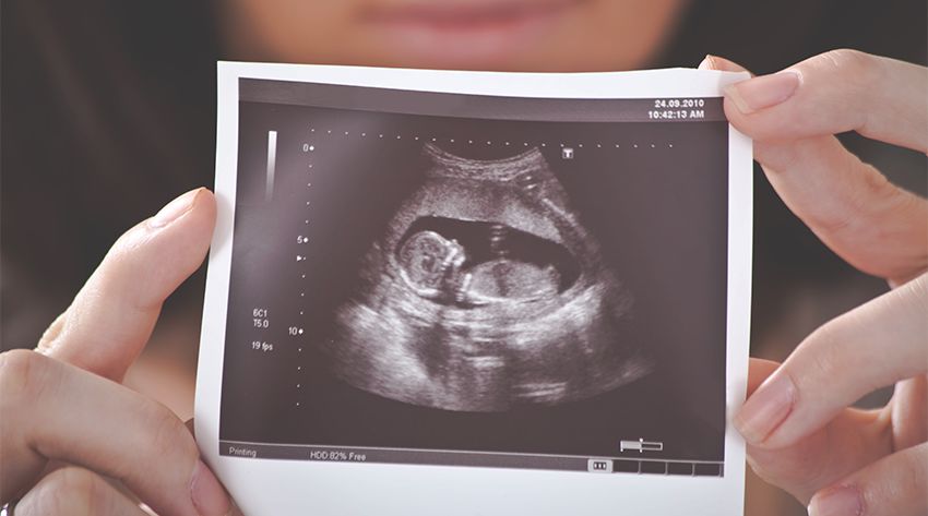 hình ảnh siêu âm thai 12 tuần